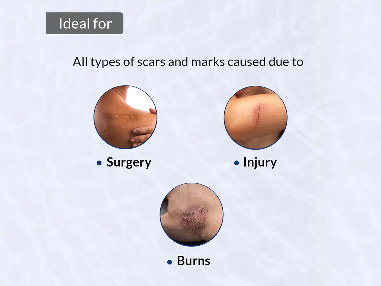 Fixderma Scar Gel