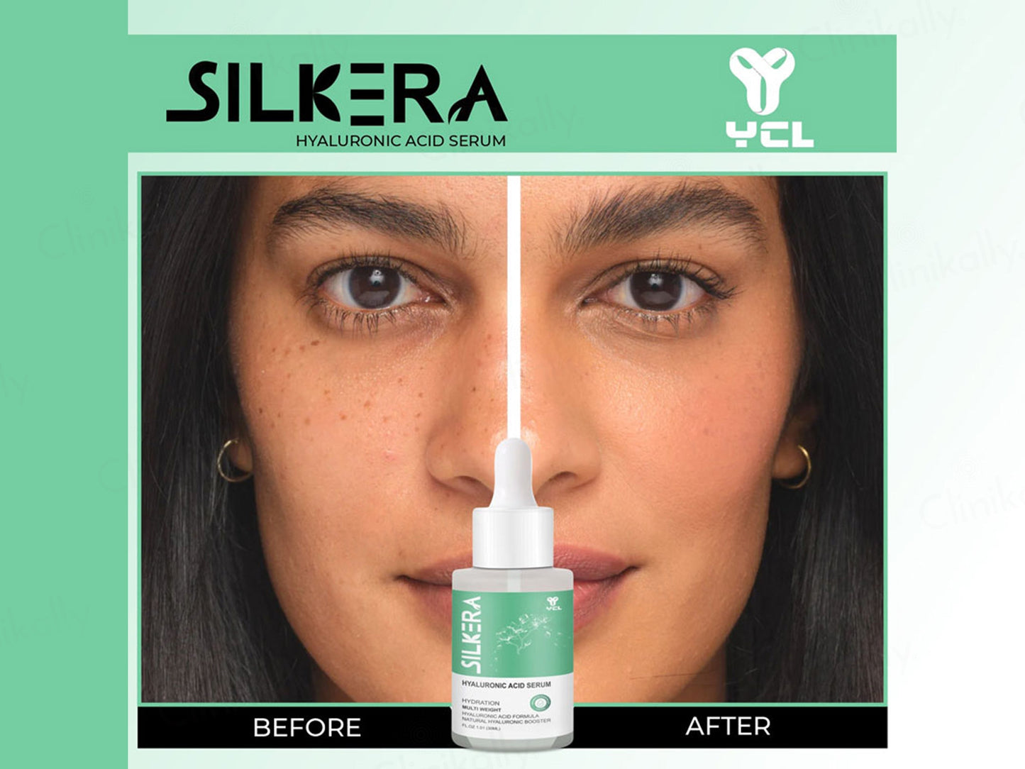 Silkera Hyaluronic Acid Serum