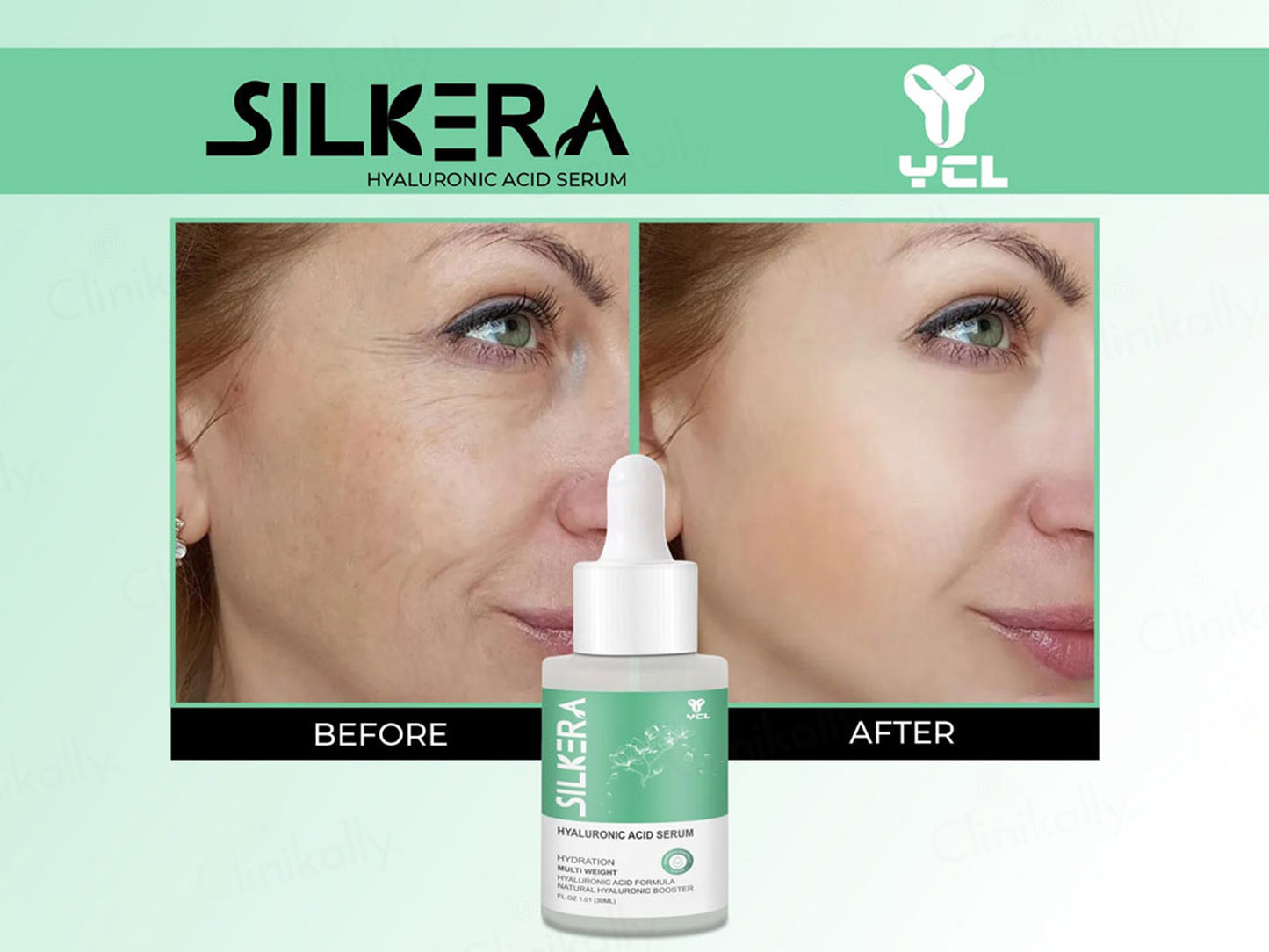 Silkera Hyaluronic Acid Serum