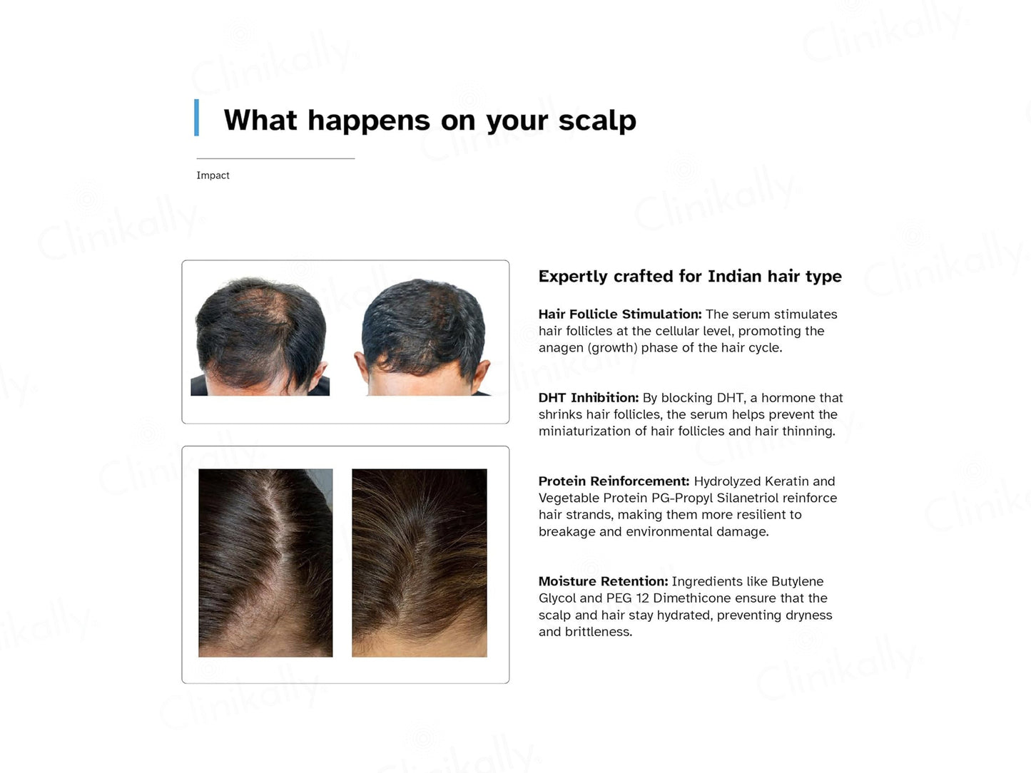Treatroot Anti-Hair Fall Serum