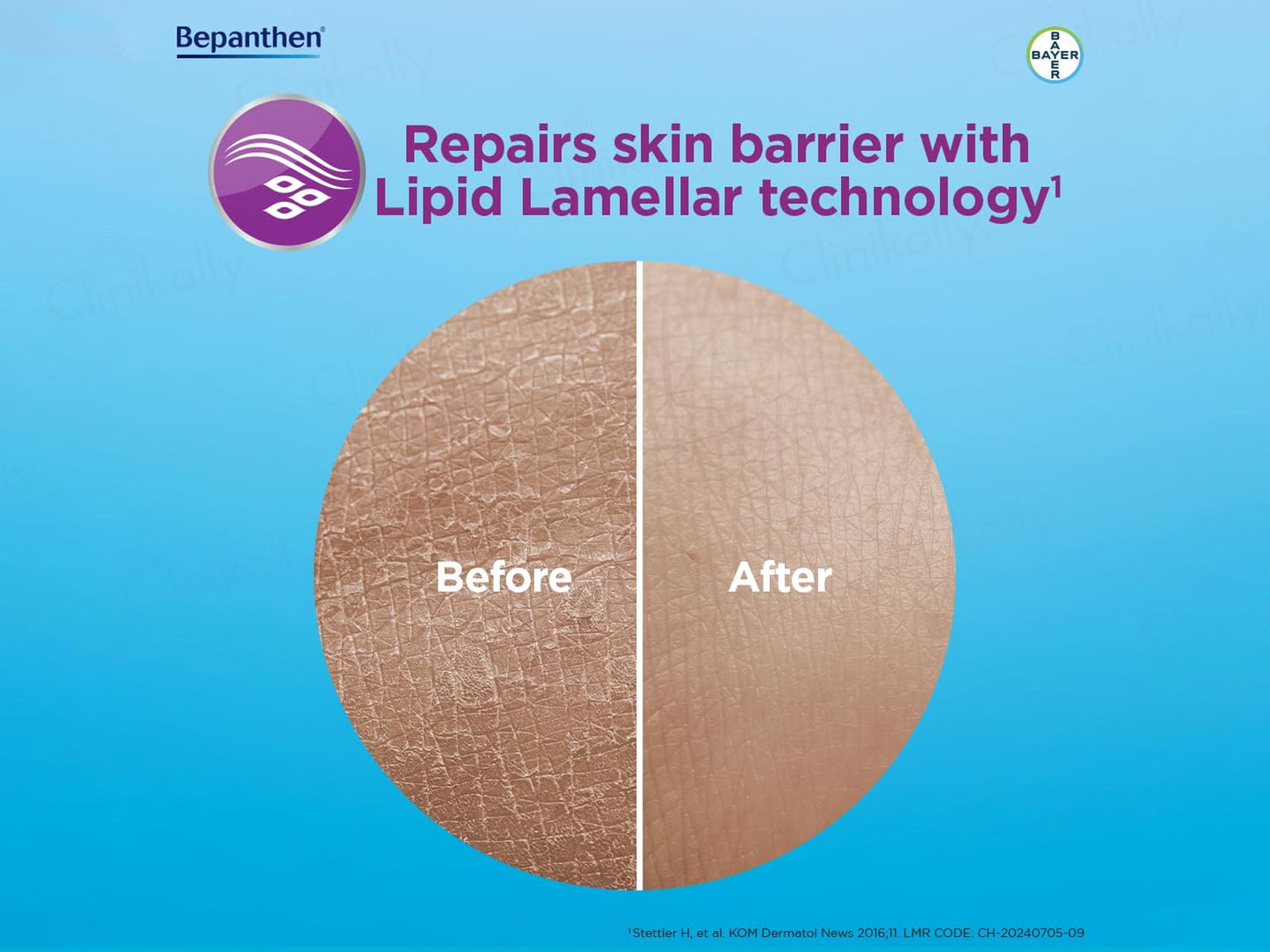 Bepanthen SensiCalm Steroid-Free Itch Relief Cream For Eczema-Prone Skin