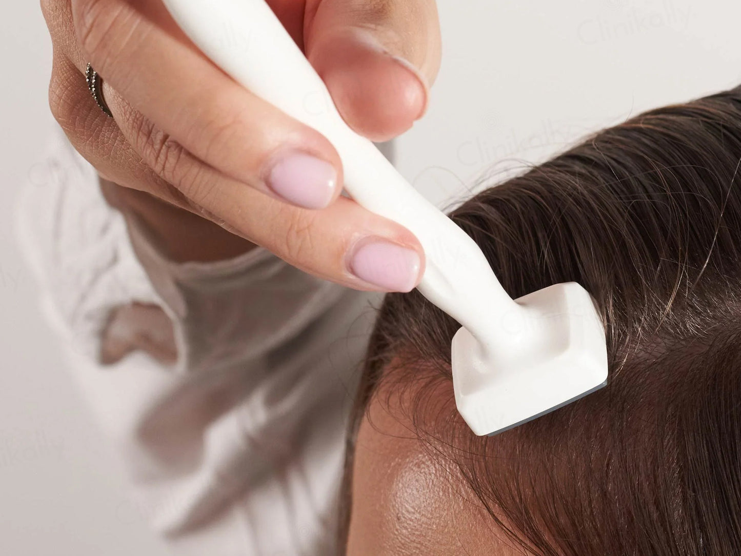 Calecim Professional Advanced Hair System