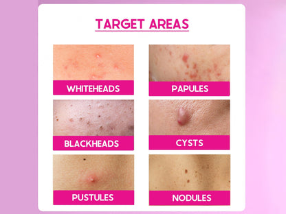 CosiQ ABP-11% AHA + BHA + PHA Gentle Exfoliating Peeling Solution