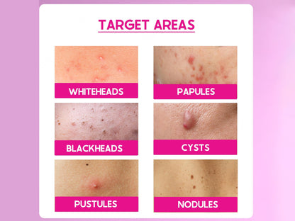 CosiQ ABP-33% AHA + BHA + PHA Strong Exfoliating Peeling Solution