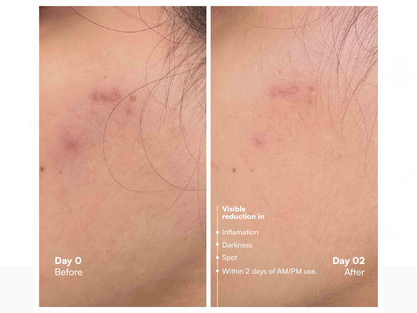 Awear Beauty Glass Skin Dual Spot Treatment Serum
