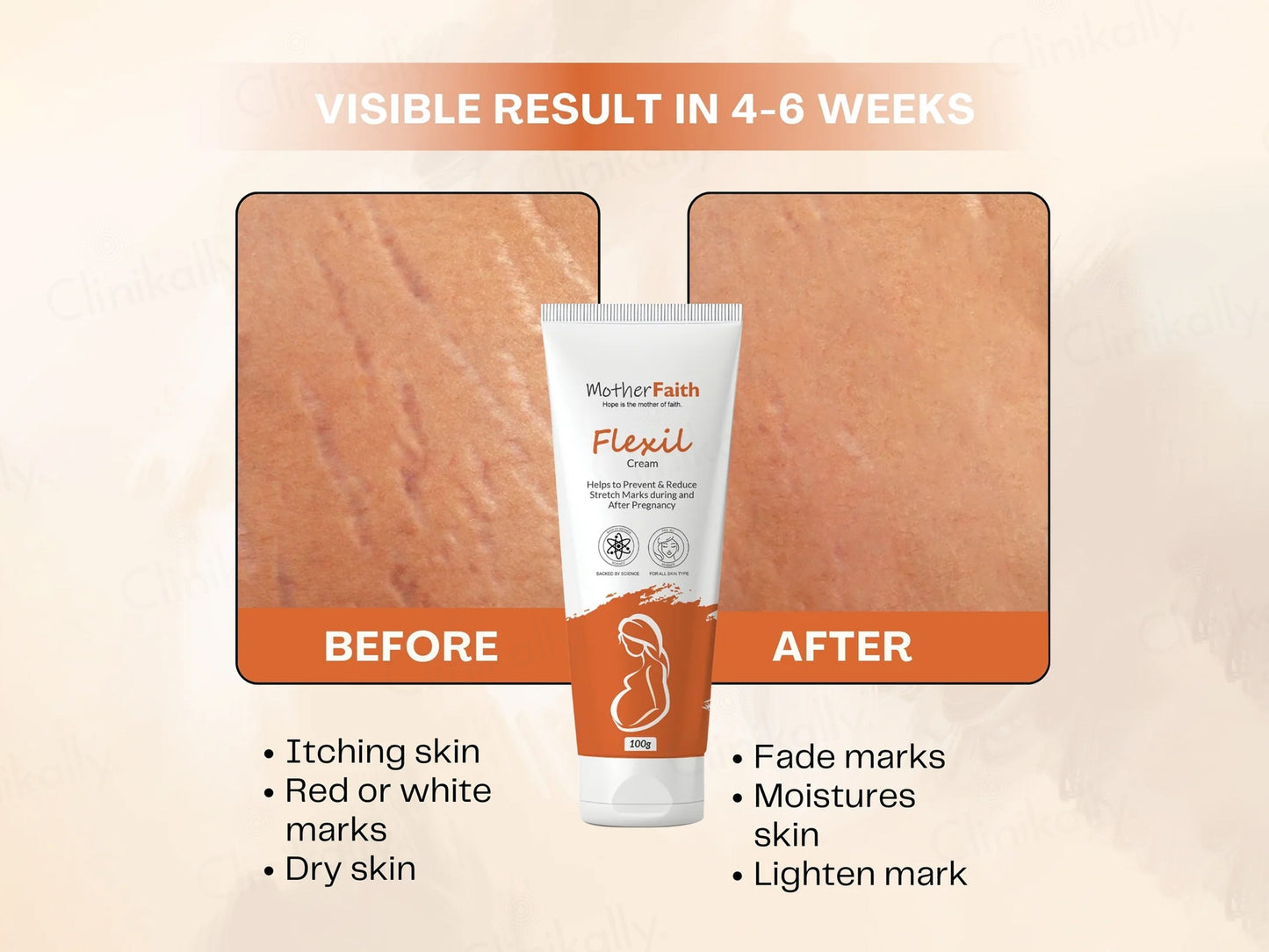 Motherfaith Flexil Stretch Marks Cream