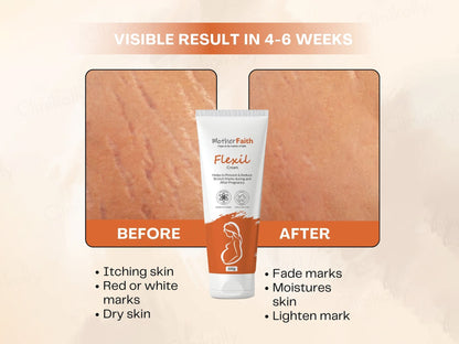 Motherfaith Flexil Stretch Marks Cream