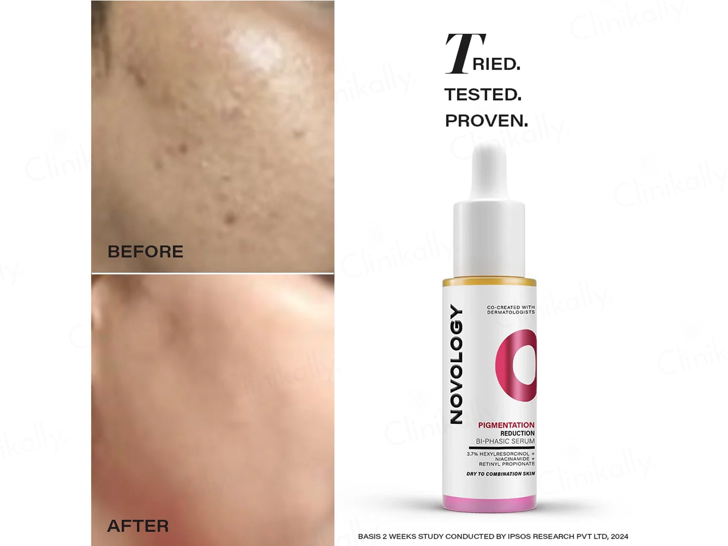 Novology Pigmentation Reduction Bi-Phasic Serum For Dry To Combination Skin