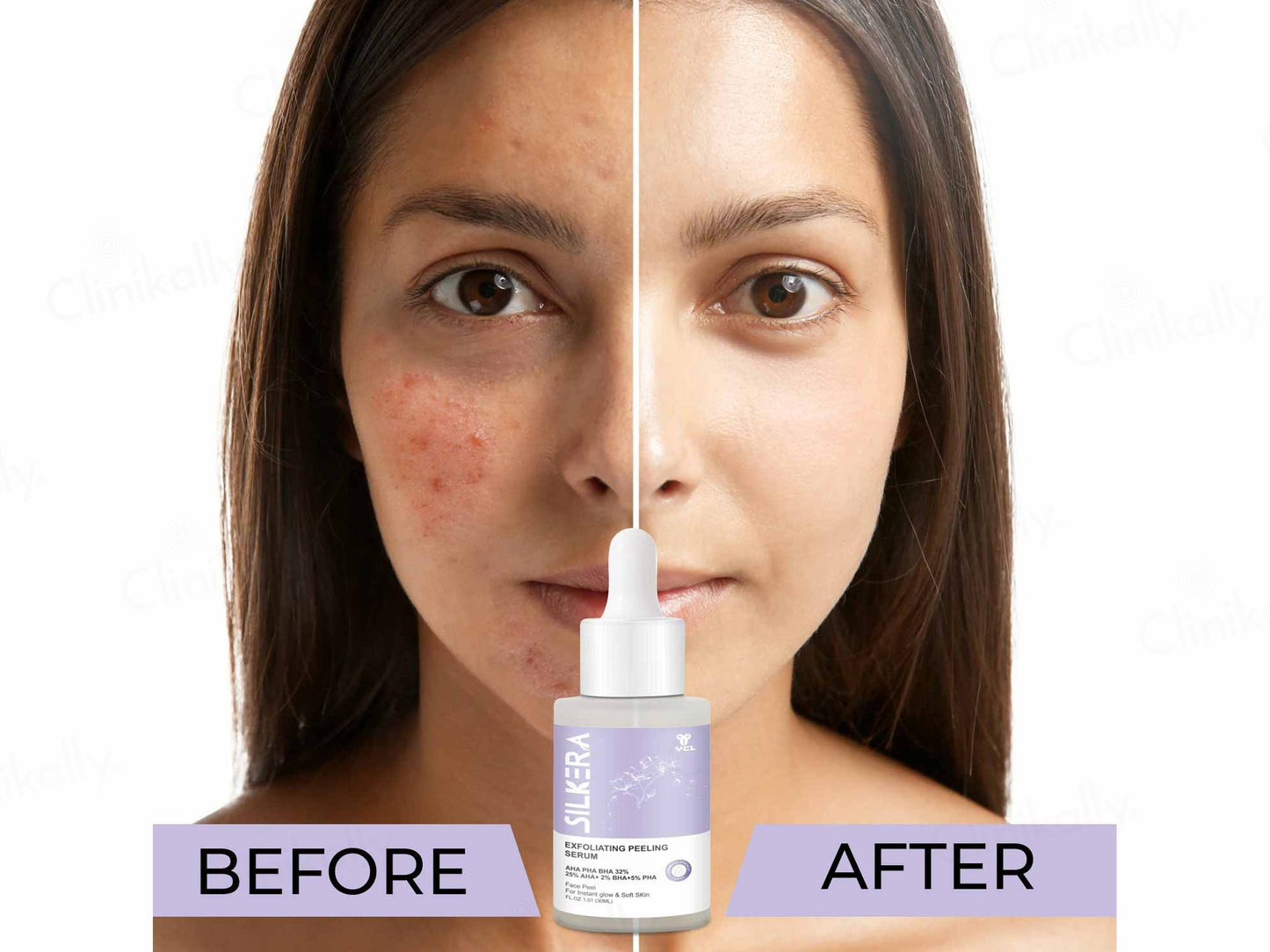 Silkera Exfoliating Peeling Serum