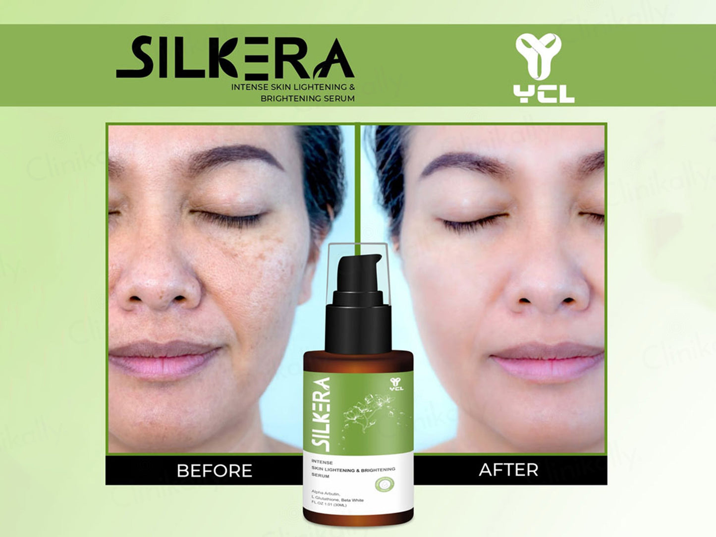 Silkera Skin Lightening & Brightening Serum