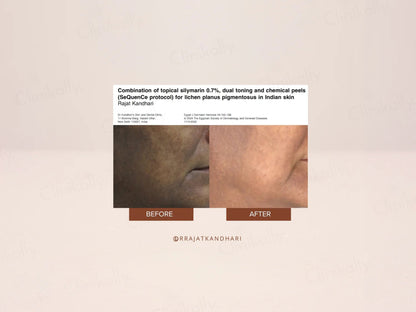 The Facecraft Project Restore Retinol Skin Brightening Cream
