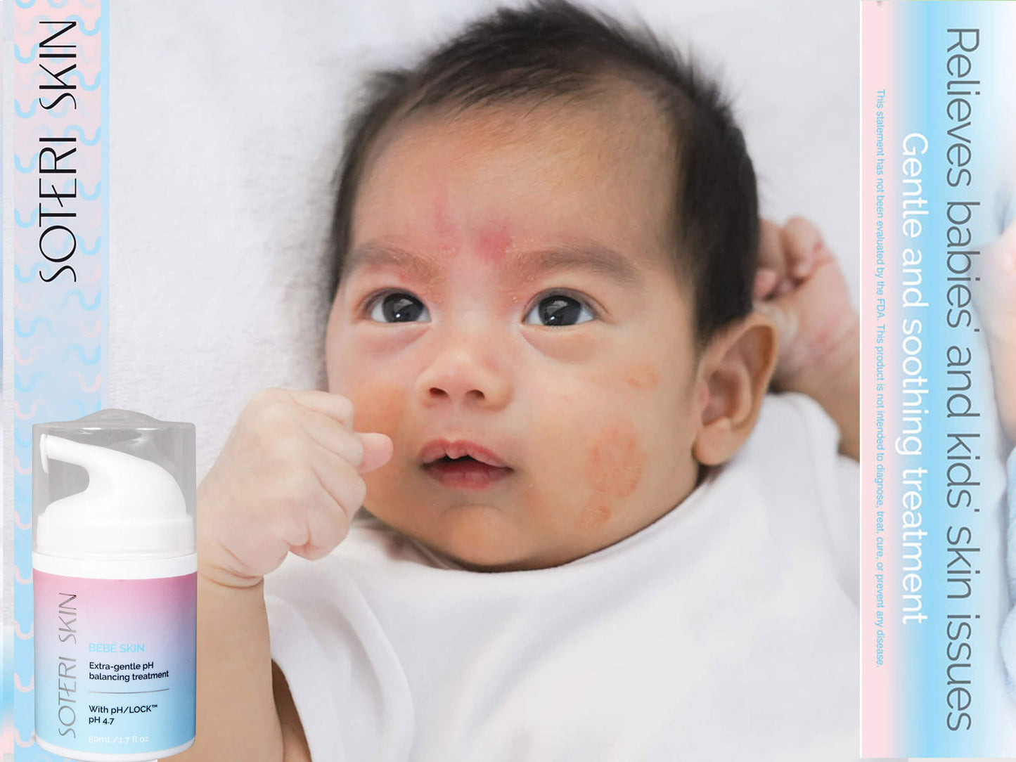 Soteri Skin BEBE Skin